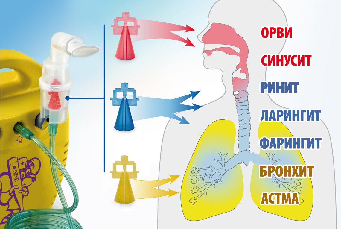 Использование небулайзера презентация